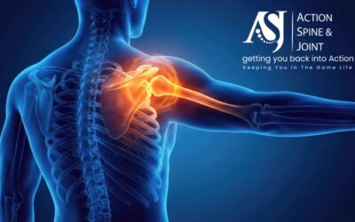 Shockwave Therapy in Nashville: Advanced Treatment for Chronic Pain
