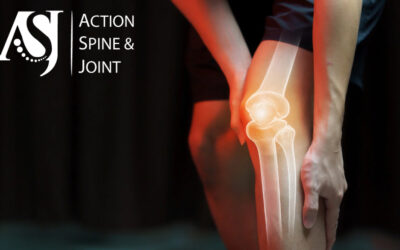 Knee Decompression Therapy: Restoring Mobility Without Surgery